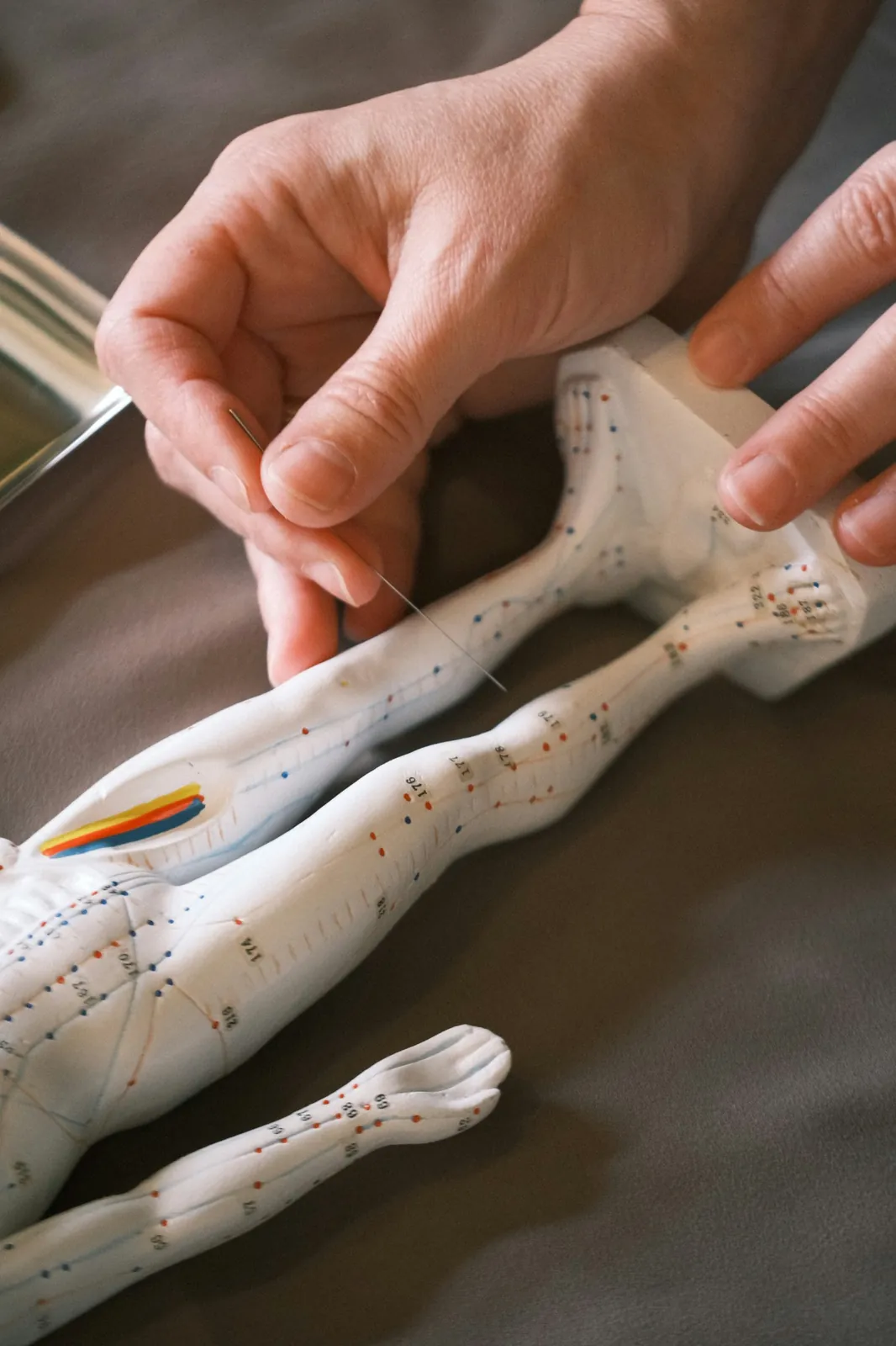 Acupuncture needle positioned over an anatomical meridian model to illustrate acupuncture care after an auto accident