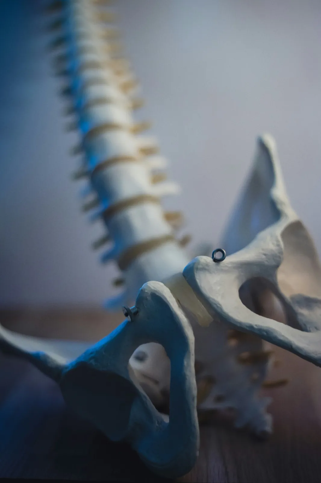 Anatomical spine and pelvis model illustrating chiropractic evaluation after an auto accident