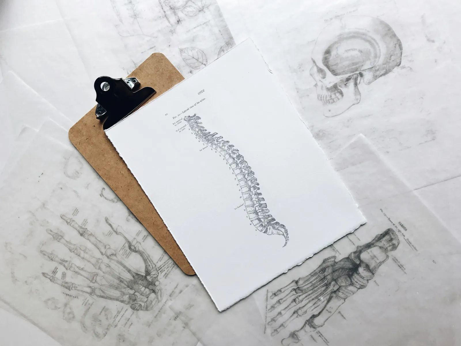 Clipboard with anatomical spine and skeletal drawings representing medical documentation for a personal-injury case