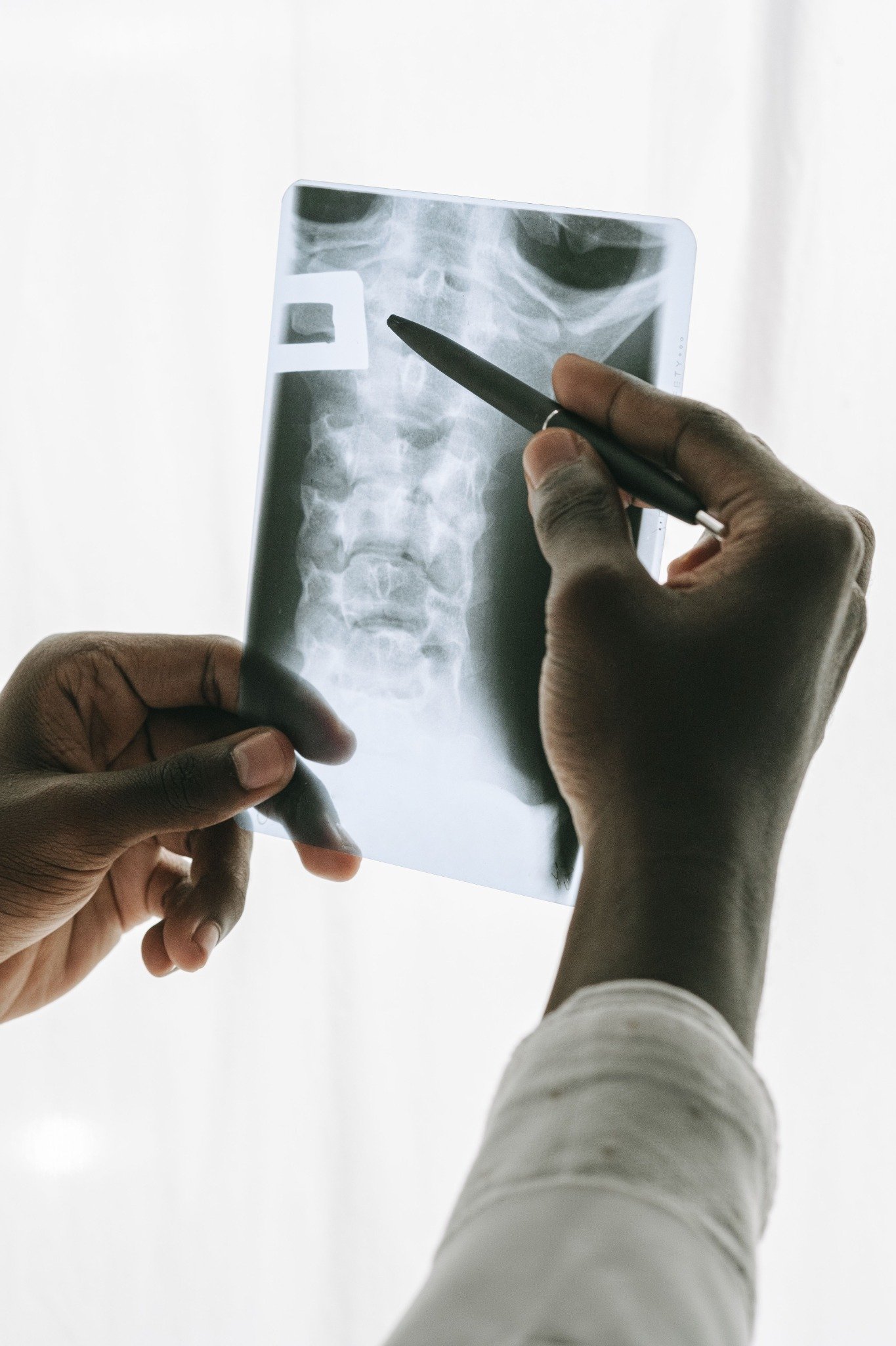 Clinician reviewing an X-ray during a whiplash evaluation